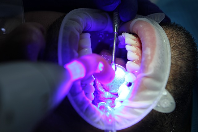 bělení zubů